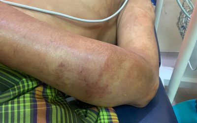 Tidak Diberikan Pinjaman, Tetangga Aniaya Korban Hingga Alami Luka-luka