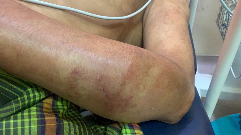 Tidak Diberikan Pinjaman, Tetangga Aniaya Korban Hingga Alami Luka-luka