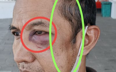Diduga Aniaya Pria di Pandaan, Seorang Warga Dilaporkan ke Polisi