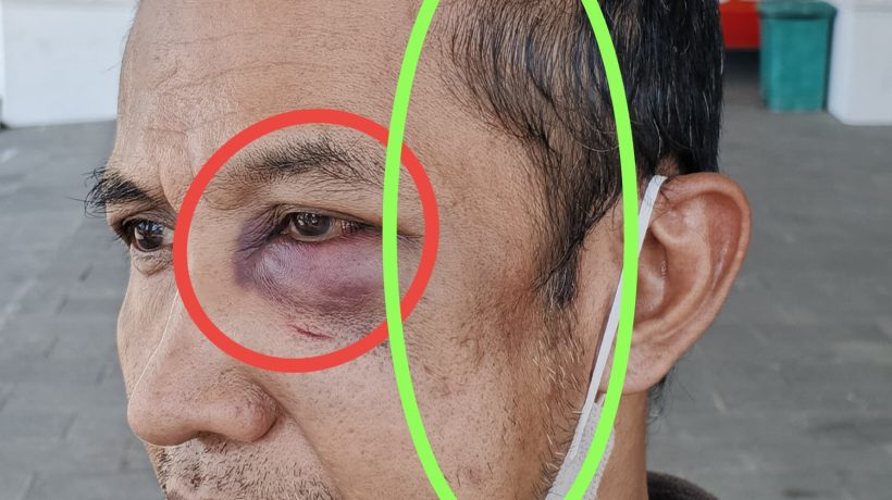 Diduga Aniaya Pria di Pandaan, Seorang Warga Dilaporkan ke Polisi